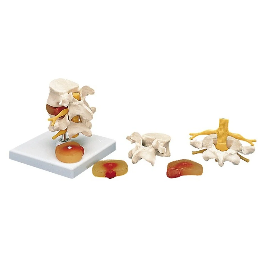 Miniature 1